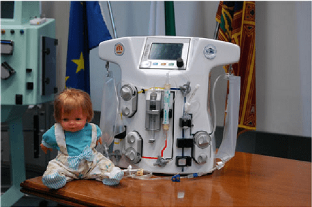 CA.R.PE.DI.E.M. First Continuous Dialysis Device for Pediatric Patients